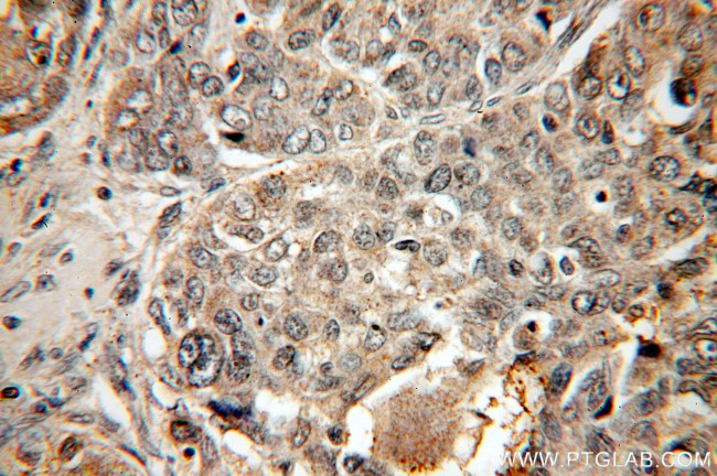 SMAD4 Antibody in Immunohistochemistry (Paraffin) (IHC (P))