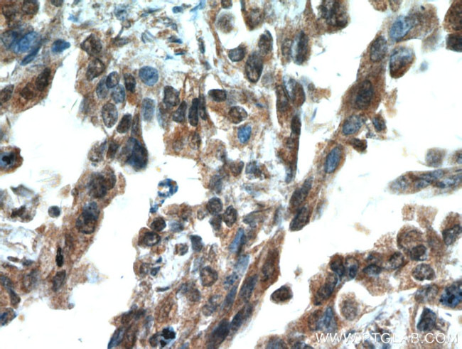 SMAD4 Antibody in Immunohistochemistry (Paraffin) (IHC (P))