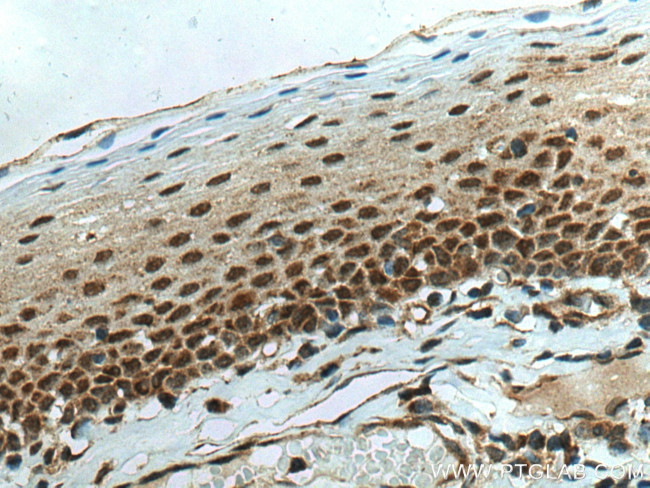 SMAD4 Antibody in Immunohistochemistry (Paraffin) (IHC (P))