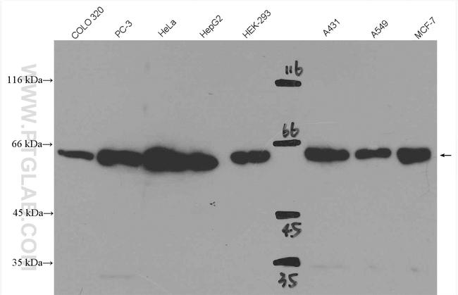 SMAD4 Antibody in Western Blot (WB)