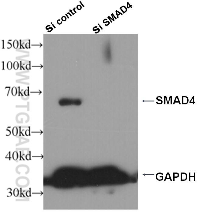 SMAD4 Antibody in Western Blot (WB)