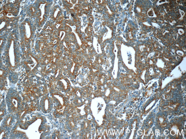 MEK1 Antibody in Immunohistochemistry (Paraffin) (IHC (P))