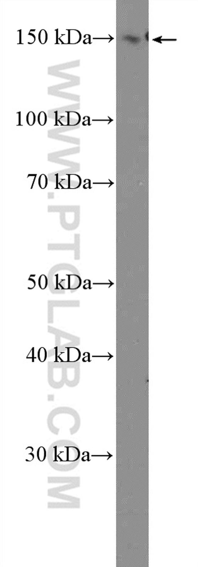 PLCB3 Antibody in Western Blot (WB)