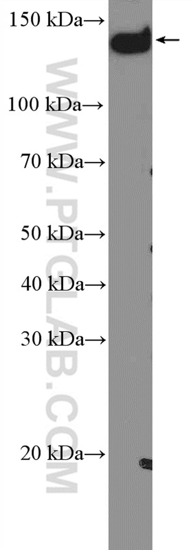 PLCB3 Antibody in Western Blot (WB)