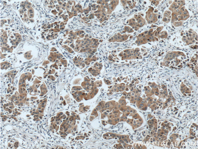 PPP1R13L Antibody in Immunohistochemistry (Paraffin) (IHC (P))