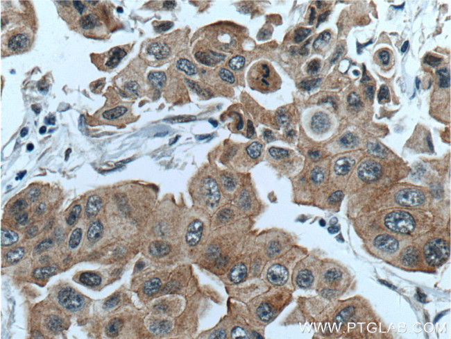 PPP1R13L Antibody in Immunohistochemistry (Paraffin) (IHC (P))