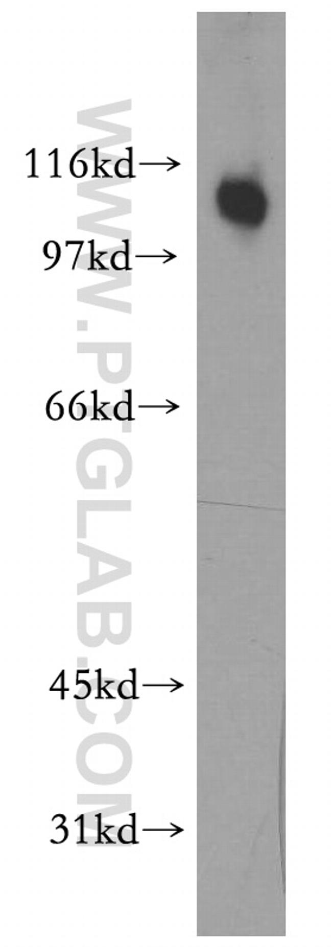 PPP1R13L Antibody in Western Blot (WB)