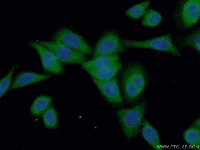 HYAL2 Antibody in Immunocytochemistry (ICC/IF)