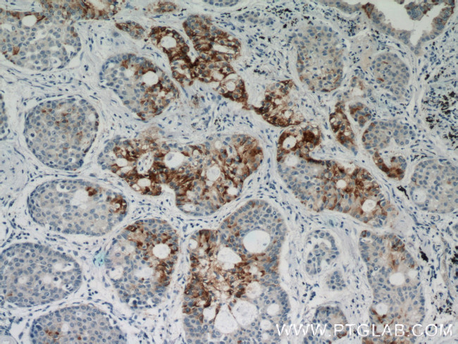 HYAL2 Antibody in Immunohistochemistry (Paraffin) (IHC (P))