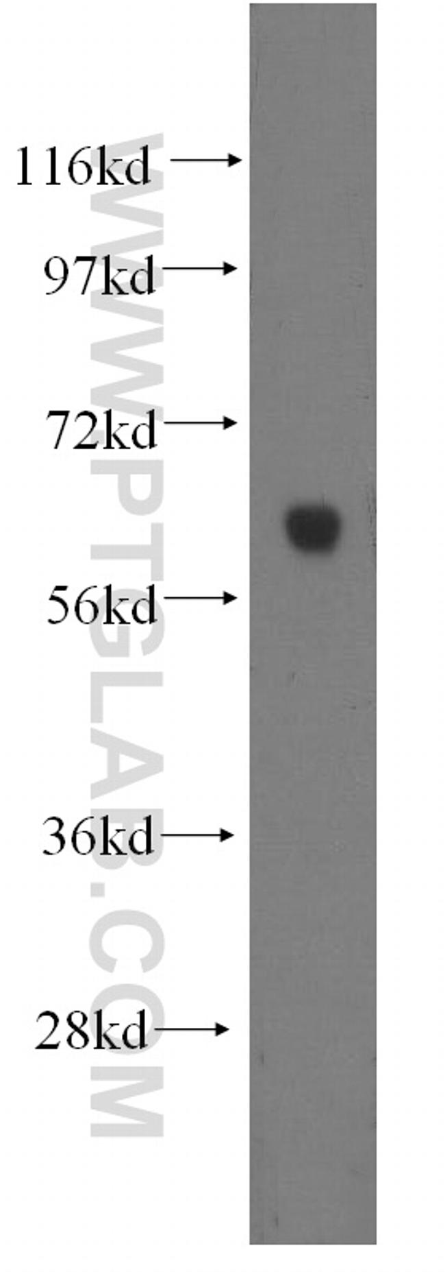 HYAL2 Antibody in Western Blot (WB)