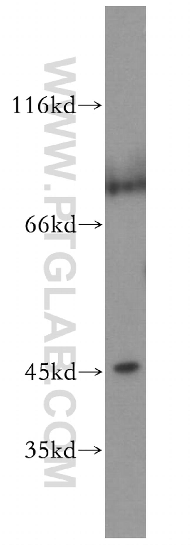 JNK Antibody in Western Blot (WB)