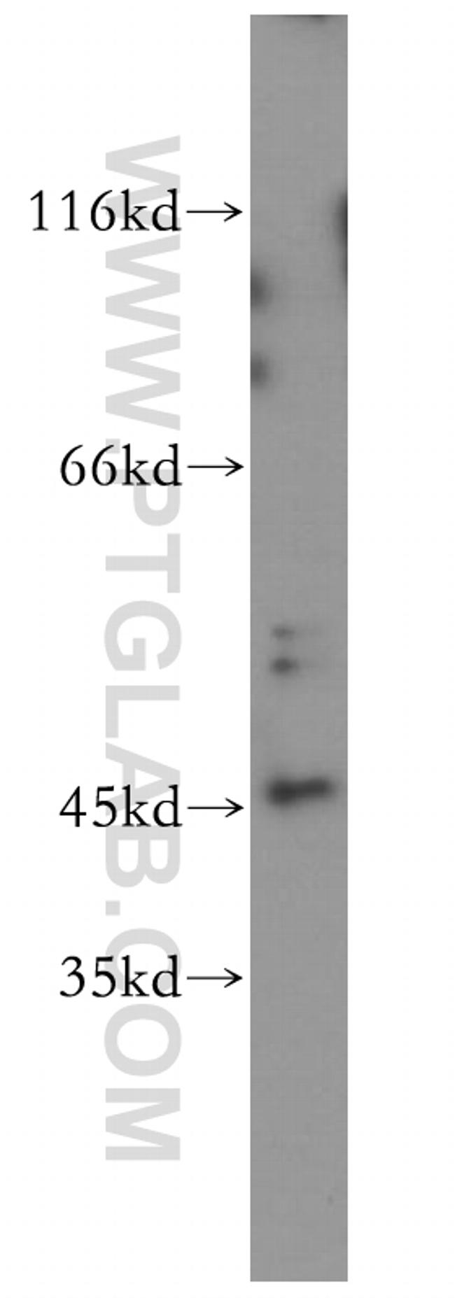 JNK Antibody in Western Blot (WB)