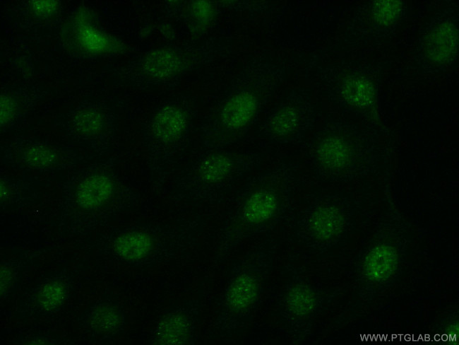 JNK Antibody in Immunocytochemistry (ICC/IF)