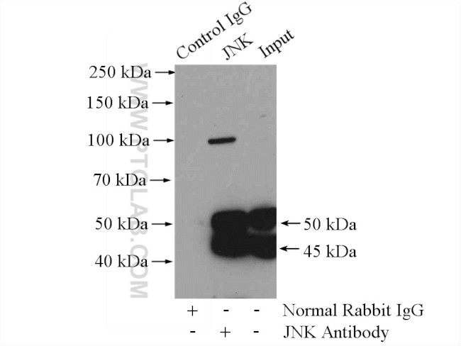 JNK Antibody in Immunoprecipitation (IP)