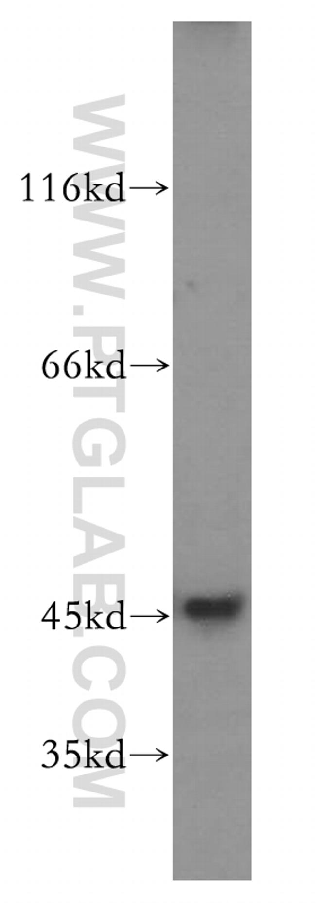 JNK Antibody in Western Blot (WB)