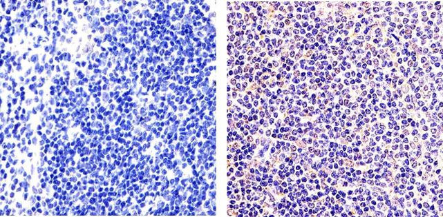 NFkB p50 Antibody in Immunohistochemistry (Paraffin) (IHC (P))