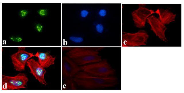 NFkB p50 Antibody in Immunocytochemistry (ICC/IF)