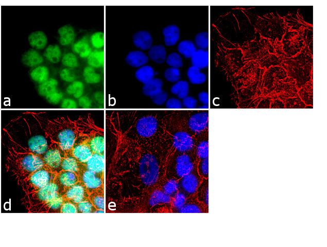 HDAC2 Antibody in Immunocytochemistry (ICC/IF)