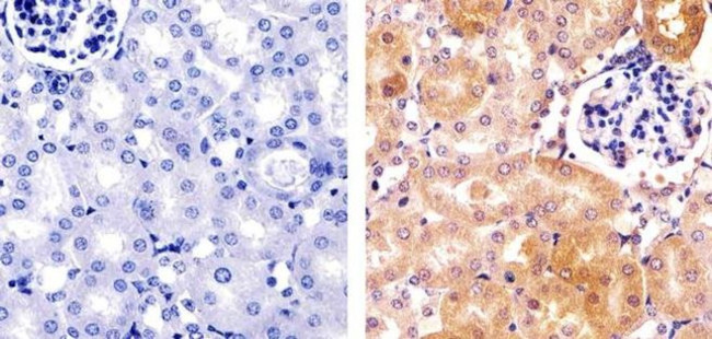 HDAC2 Antibody in Immunohistochemistry (Paraffin) (IHC (P))