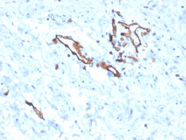 CD31/PECAM-1 Antibody in Immunohistochemistry (Paraffin) (IHC (P))