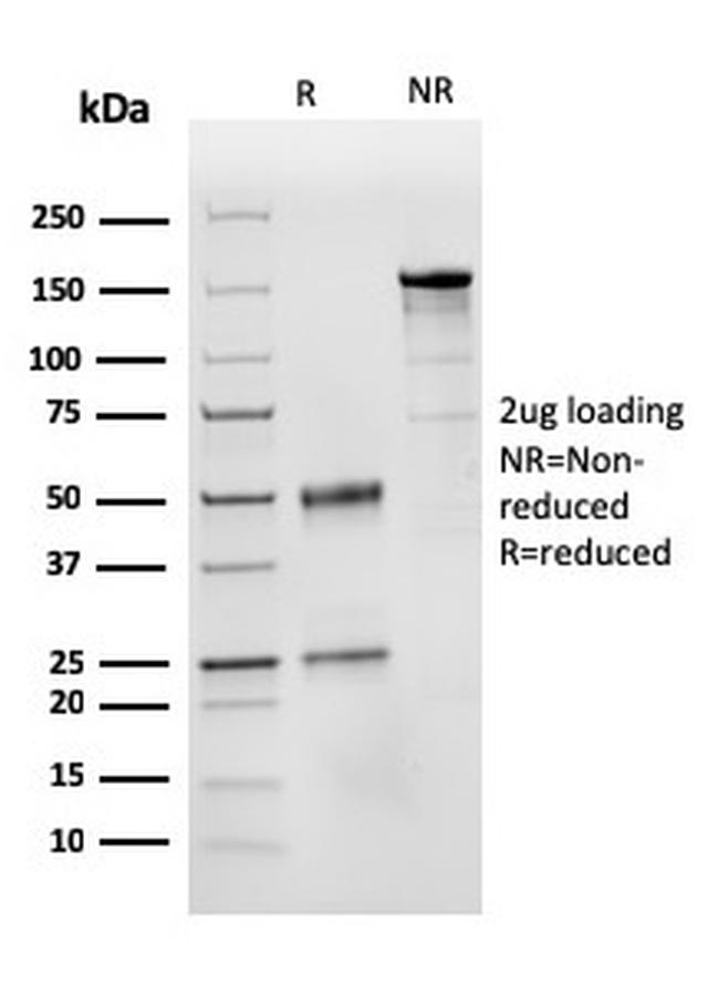 CD31/PECAM-1 Antibody in SDS-PAGE (SDS-PAGE)