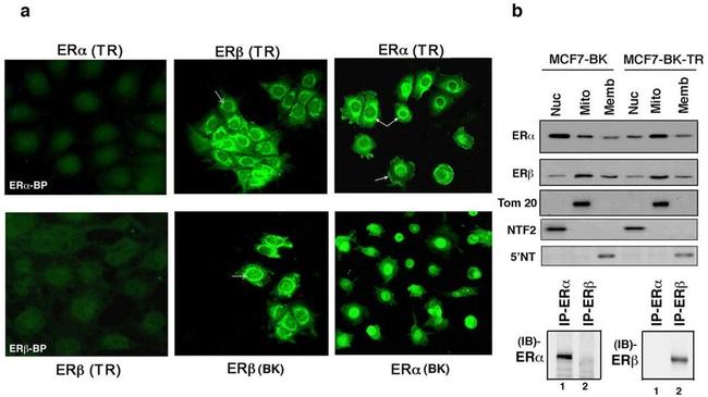 Estrogen Receptor beta Antibody in Western Blot, Immunocytochemistry (WB, ICC/IF)