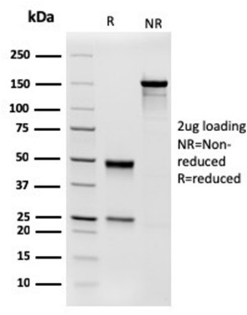 Aciculin/Phosphoglucomutase 5 (PGM5) Antibody in SDS-PAGE (SDS-PAGE)