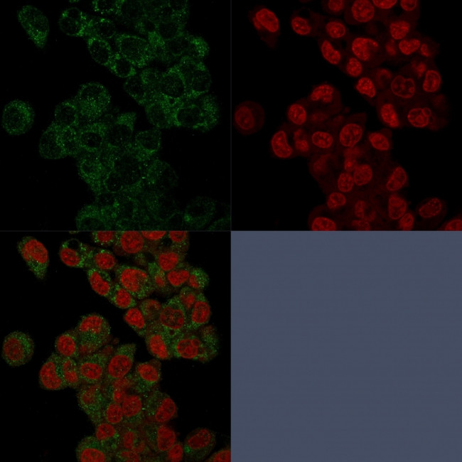 Prohibitin (Mitochondrial Marker) Antibody in Immunocytochemistry (ICC/IF)