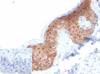 SERPINB5/Maspin Antibody in Immunohistochemistry (Paraffin) (IHC (P))