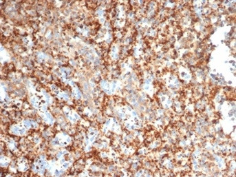 PIK3R2/Phosphoinositide-3-kinase regulatory subunit 2 Antibody in Immunohistochemistry (Paraffin) (IHC (P))