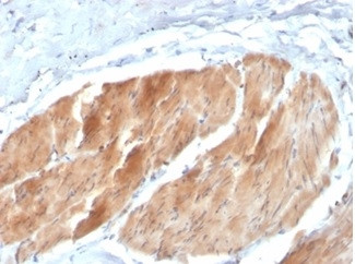 PIK3R2 (Phosphoinositide-3-kinase regulatory subunit 2) Antibody in Immunohistochemistry (Paraffin) (IHC (P))