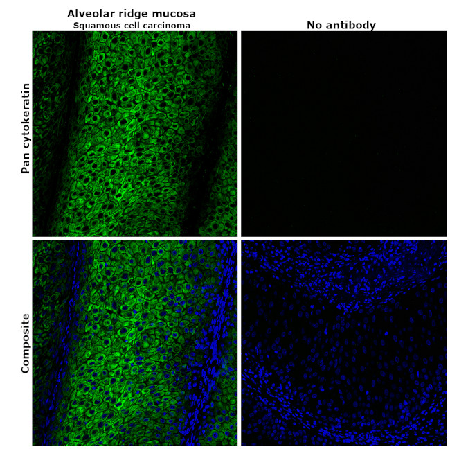 Pan Cytokeratin Antibody in Immunohistochemistry (Paraffin) (IHC (P))