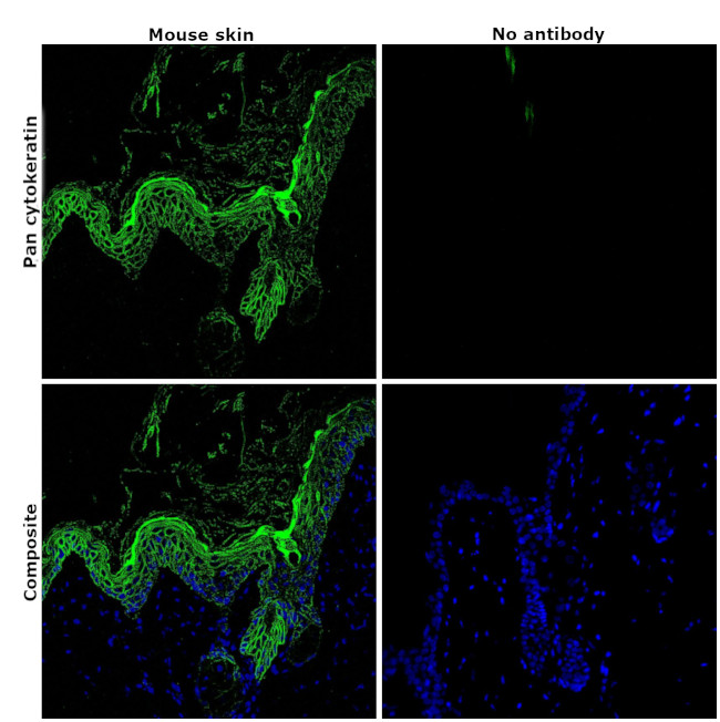 Pan Cytokeratin Antibody in Immunohistochemistry (Paraffin) (IHC (P))