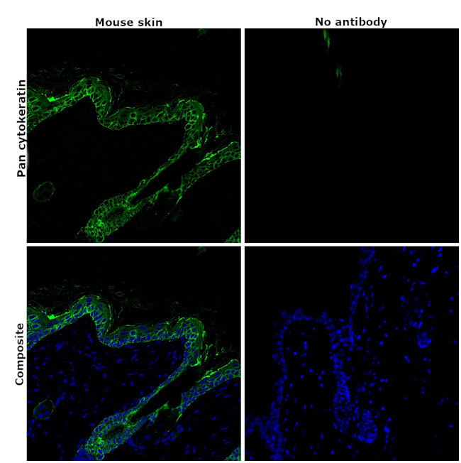 Pan Cytokeratin Antibody in Immunohistochemistry (Paraffin) (IHC (P))