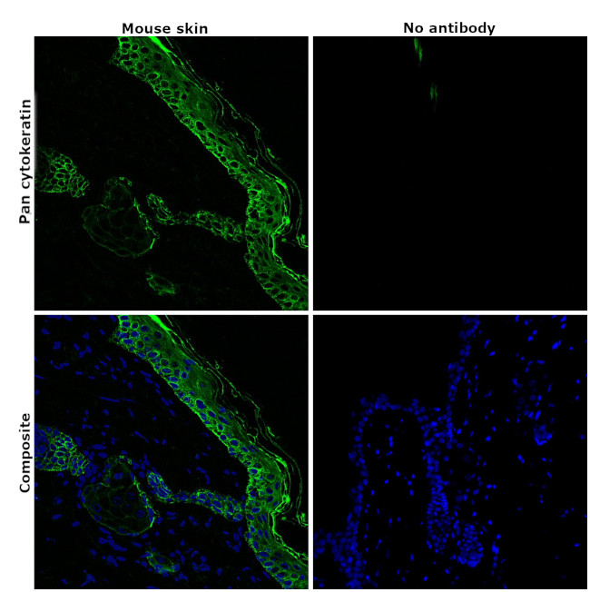 Pan Cytokeratin Antibody in Immunohistochemistry (Paraffin) (IHC (P))