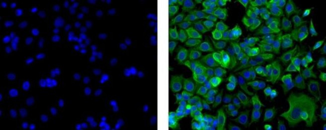 Pan Cytokeratin Antibody in Immunocytochemistry (ICC/IF)