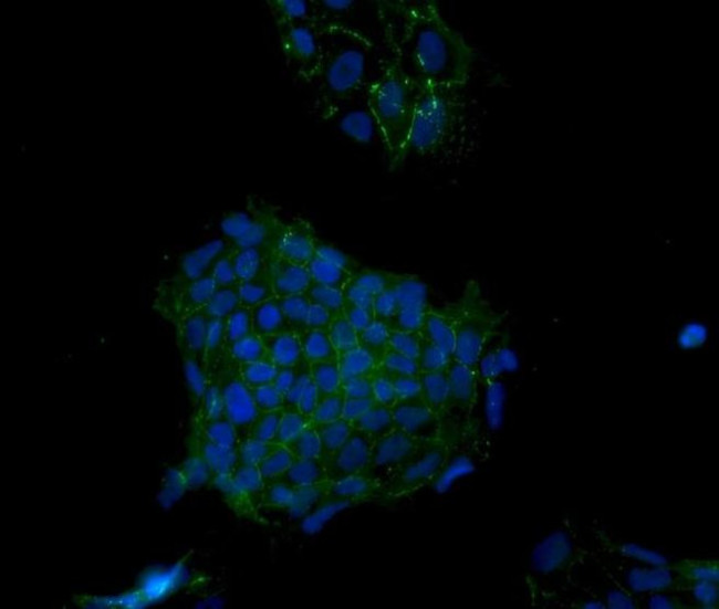 Desmoglein 2 Antibody in Immunocytochemistry (ICC/IF)