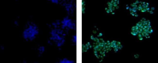 Why Is ImmunoPrecise Antibodies (IPA) Stock Down 39% Today