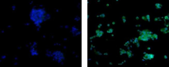 Arginase 1 Antibody in Immunocytochemistry (ICC/IF)