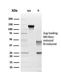 Proteolipid Protein/Myelin PLP Antibody in SDS-PAGE (SDS-PAGE)