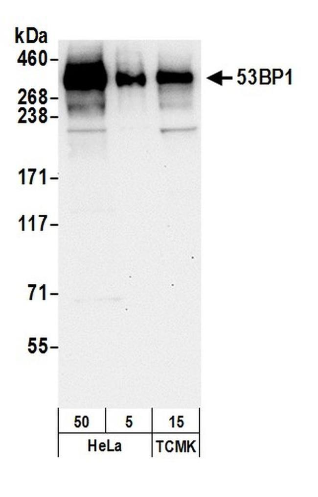 53BP1 Antibody in Western Blot (WB)