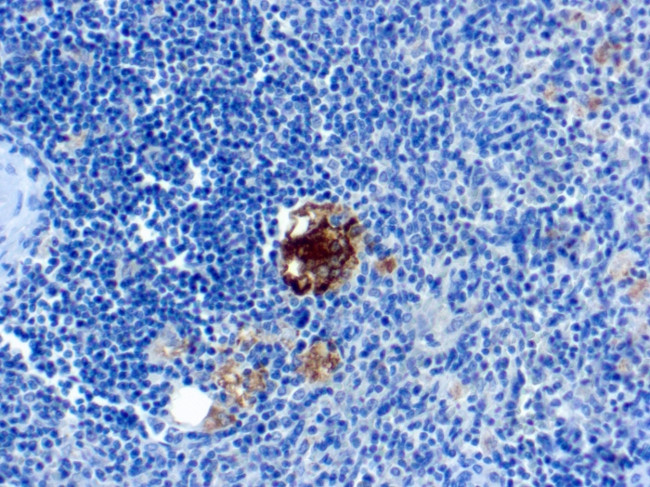 TRAcP (Tartrate-Resistant Acid Phosphatase) (Hairy Cell Leukemia Marker) Antibody in Immunohistochemistry (Paraffin) (IHC (P))