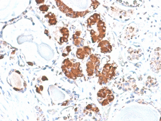 ACTH (Adrenocorticotrophic Hormone) (Pituitary Marker) Antibody in Immunohistochemistry (Paraffin) (IHC (P))