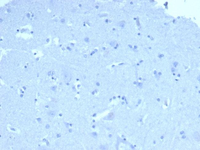 ACTH (Adrenocorticotrophic Hormone) (Pituitary Marker) Antibody in Immunohistochemistry (Paraffin) (IHC (P))