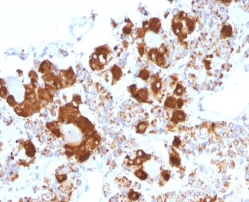 ACTH (Adrenocorticotrophic Hormone) (Pituitary Marker) Antibody in Immunohistochemistry (Paraffin) (IHC (P))