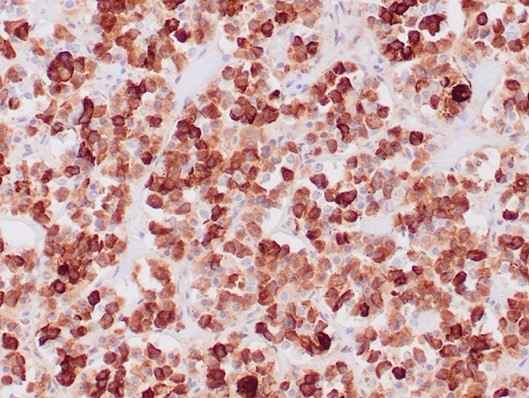 ACTH (Adrenocorticotrophic Hormone) (Pituitary Marker) Antibody in Immunohistochemistry (Paraffin) (IHC (P))