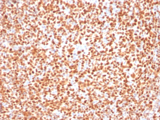 OCT-2 (POU2F2) Antibody in Immunohistochemistry (Paraffin) (IHC (P))