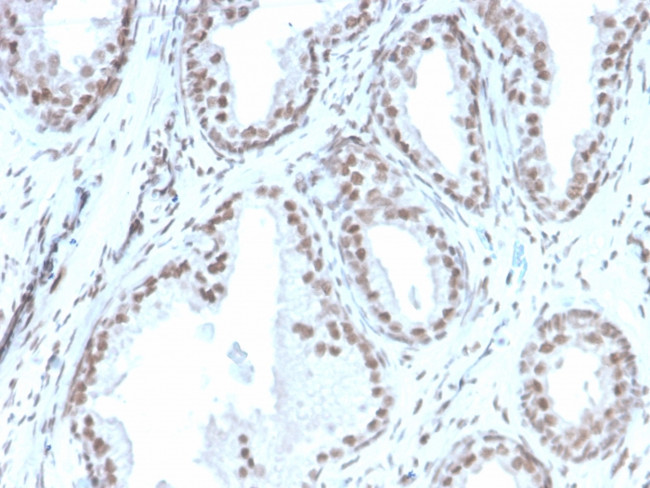 ATRX/RAD54 (Alpha Thalassemia Mental Retardation) Antibody in Immunohistochemistry (Paraffin) (IHC (P))