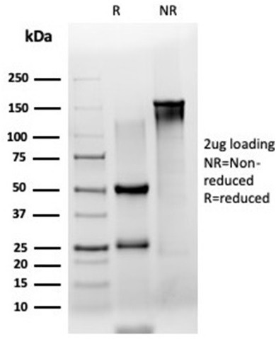 ZSCAN2 (Transcription Factor) Antibody in SDS-PAGE (SDS-PAGE)