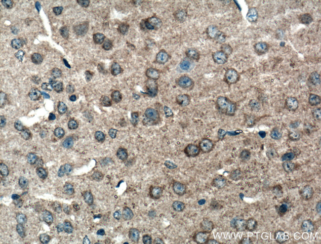 p75NTR Antibody in Immunohistochemistry (Paraffin) (IHC (P))